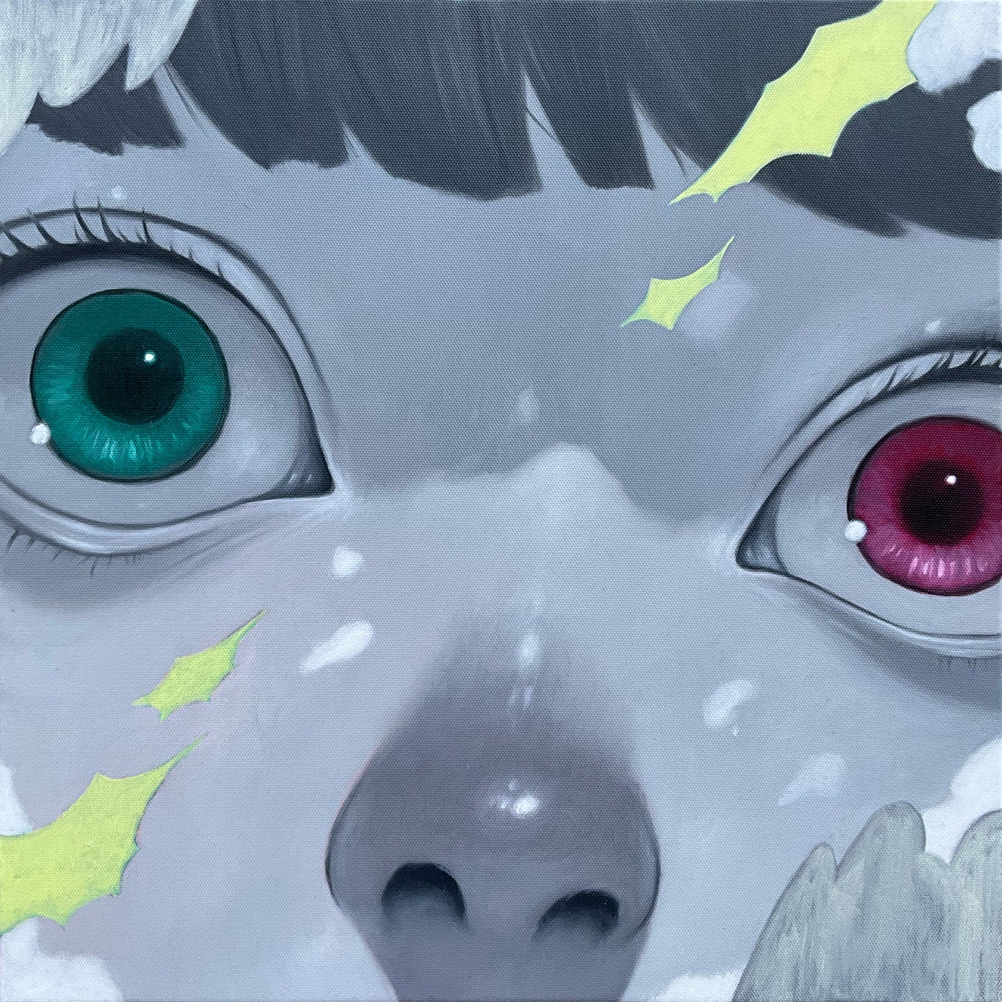 異色瞳|Heterochromia